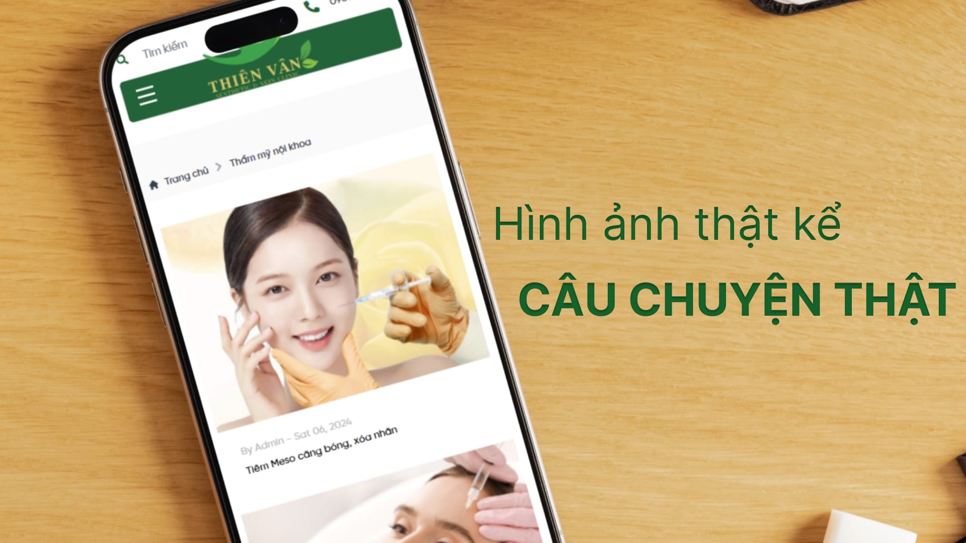 Dự Án Da Liễu Thiên Vân 4 Web Da liễu Thiên Vân mobile