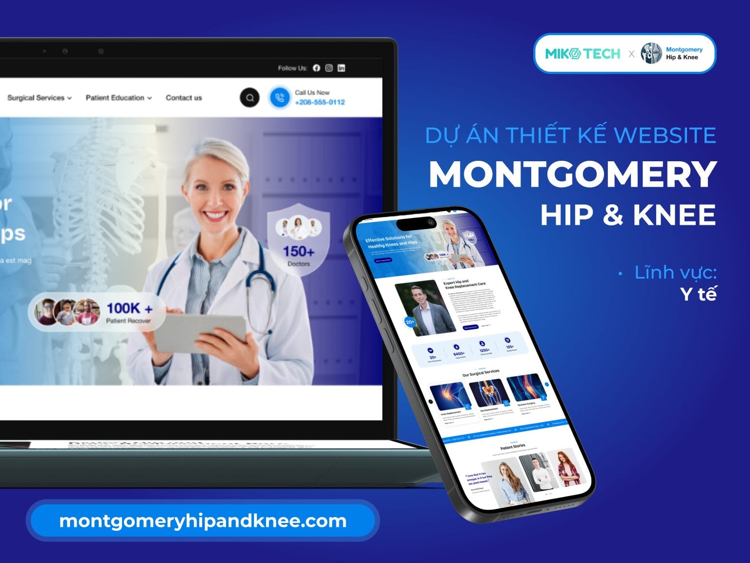 Dự án Montgomery Hip & Knee 1 Dự án Montgomery Hip & Knee